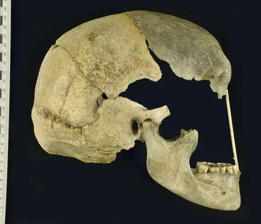 This image provided by National Museum, Prague shows the skull of an ancient human called Zlatý kůň, originally discovered in the Koněprusy caves of the Czech Republic. (Marek Jantač/National Museum, Prague via AP)