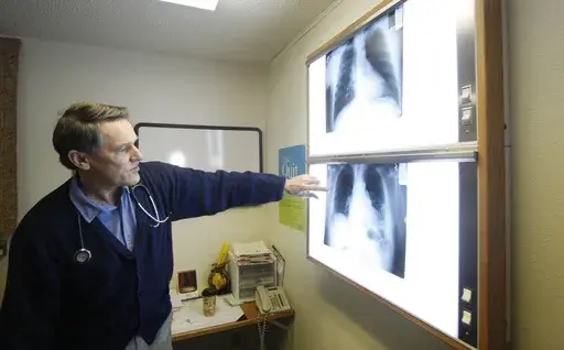 Dr. Brad Black with the Center for Asbestos Related Disease health clinic is shown looking at X-rays, Feb. 18, 2010, in Libby, Mont. (AP Photo/Rick Bowmer, File)