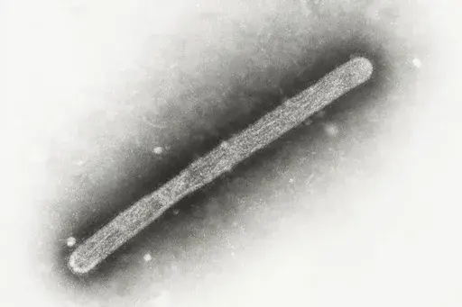 This 2005 electron microscope image shows an avian influenza A H5N1 virion. On Wednesday, May 22, 2024, Michigan health officials said a farmworker has been diagnosed with bird flu, the second human case connected to an outbreak in U.S. dairy cows. (Cynthia Goldsmith, Jackie Katz/CDC via AP)